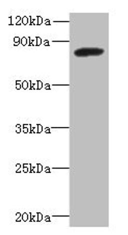 Western blot. All lanes: PBXIP1 antibody at 4µg/ml + A549 whole cell lysate. Secondary. Goat polyclonal to rabbit IgG at 1/10000 dilution. Predicted band size: 81, 78, 73 kDa. Observed band size: 81 kDa