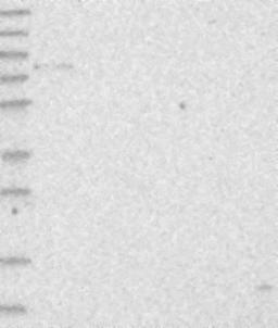 Western Blot: IGSF1 Antibody [NBP2-14119] - Lane 1: Marker [kDa] 230, 130, 95, 72, 56, 36, 28, 17, 11<br/>Lane 2: RT-4<br/>Lane 3: U-251 MG<br/>Lane 4: Human Plasma<br/>Lane 5: Liver<br/>Lane 6: Tonsil