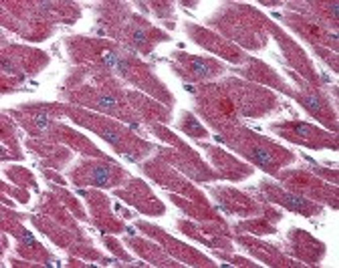 Immunohistochemistry staining of LPAR3 in heart tissue using LPAR3 Antibody.