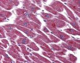 Immunohistochemistry staining of LPAR3 in heart tissue using LPAR3 Antibody.