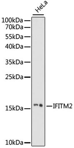 Western blot - IFITM2 antibody (A15133)