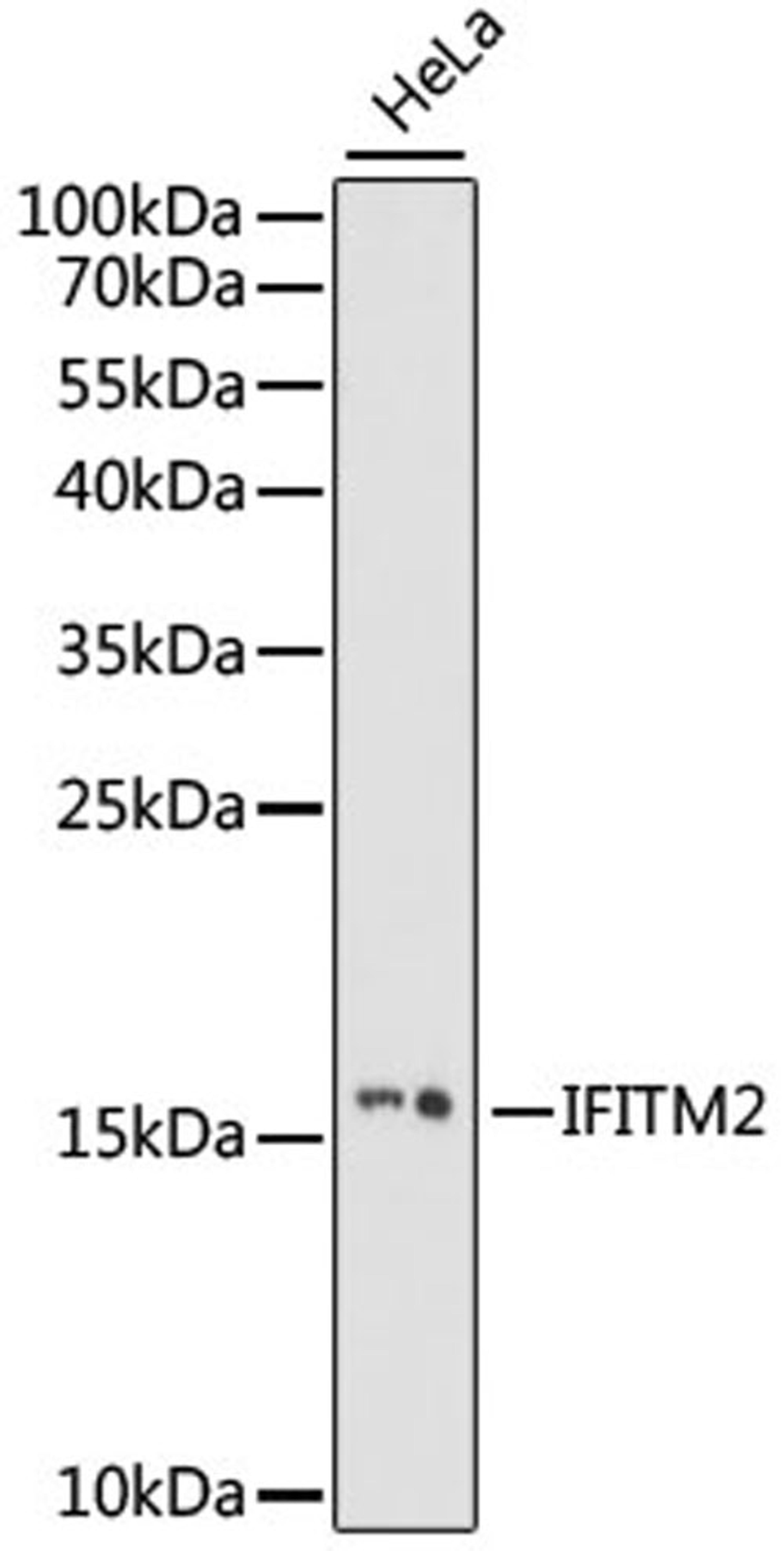 Western blot - IFITM2 antibody (A15133)