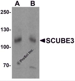 Western blot analysis of SCUBE3 in mouse kidney tissue lysate with SCUBE3 antibody at (A) 1 and (B) 2 &#956;g/mL.