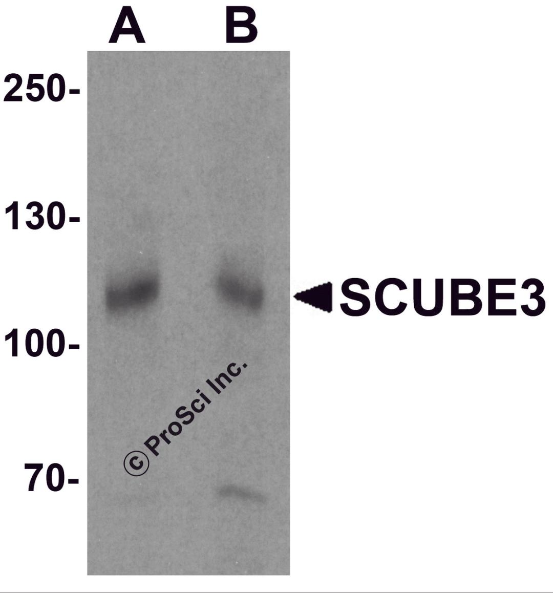 Western blot analysis of SCUBE3 in mouse kidney tissue lysate with SCUBE3 antibody at (A) 1 and (B) 2 μg/mL.