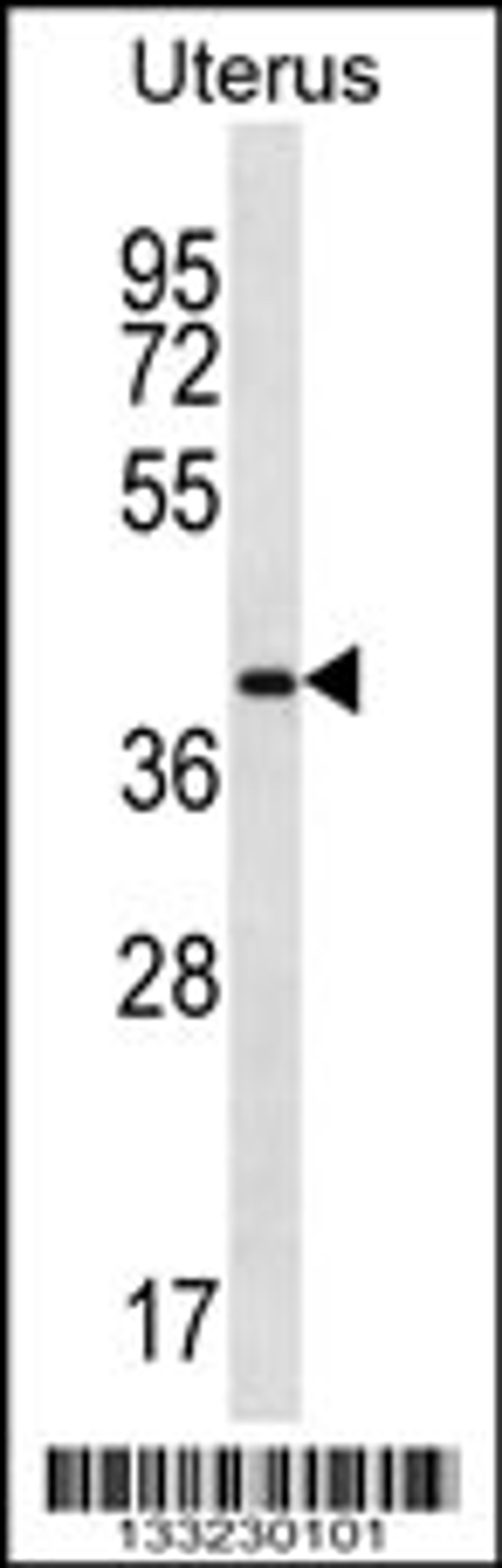 Western blot analysis in human normal Uterus tissue lysates (35ug/lane).