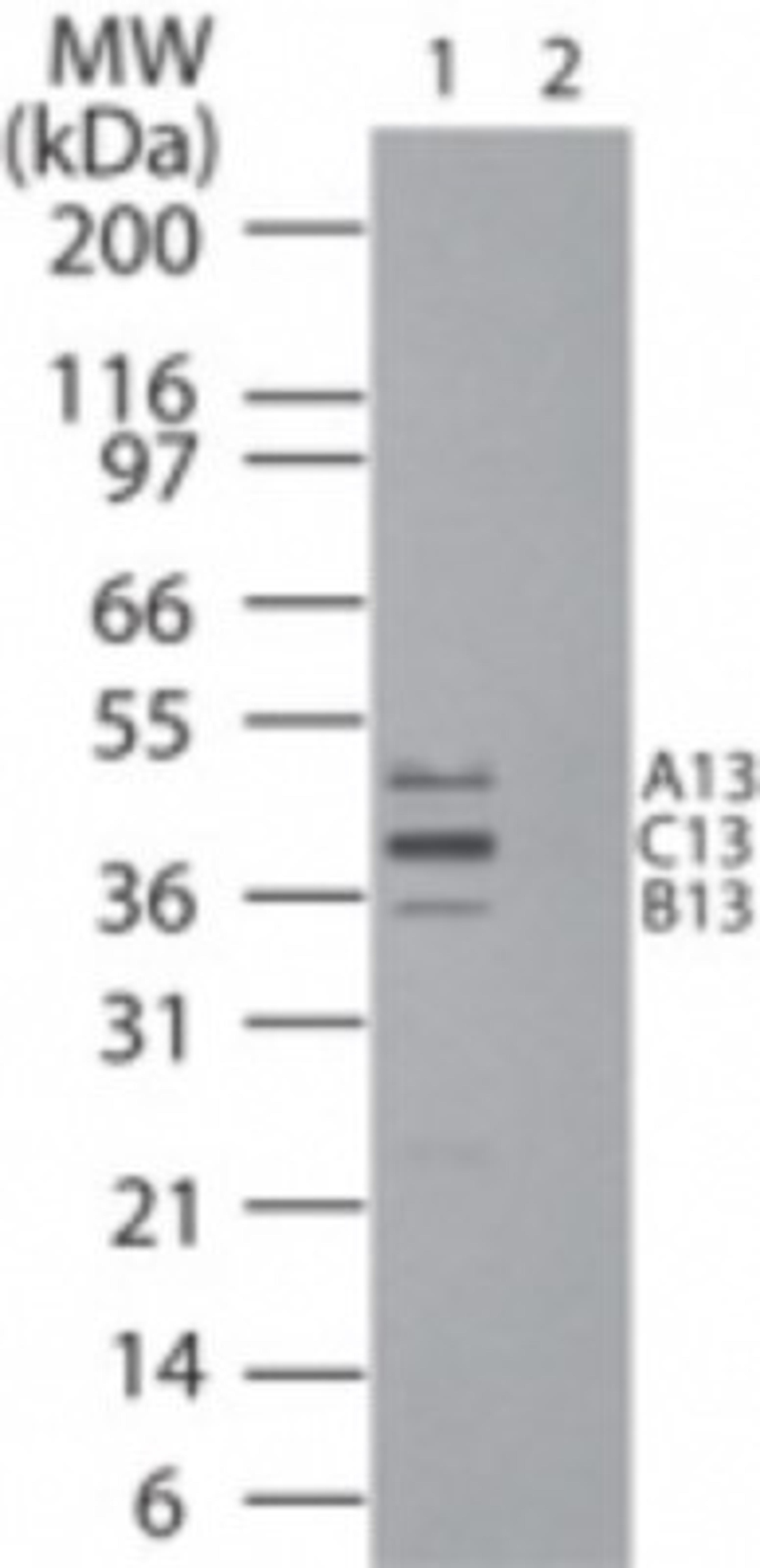 Western Blot: HOXB13 Antibody [NB100-2492] - Western blot analysis of HOXB13, A13 and C13 in HeLa cell lysate in the 1) absence and 2) presence of immunizing peptide at 1:5000 dilution.