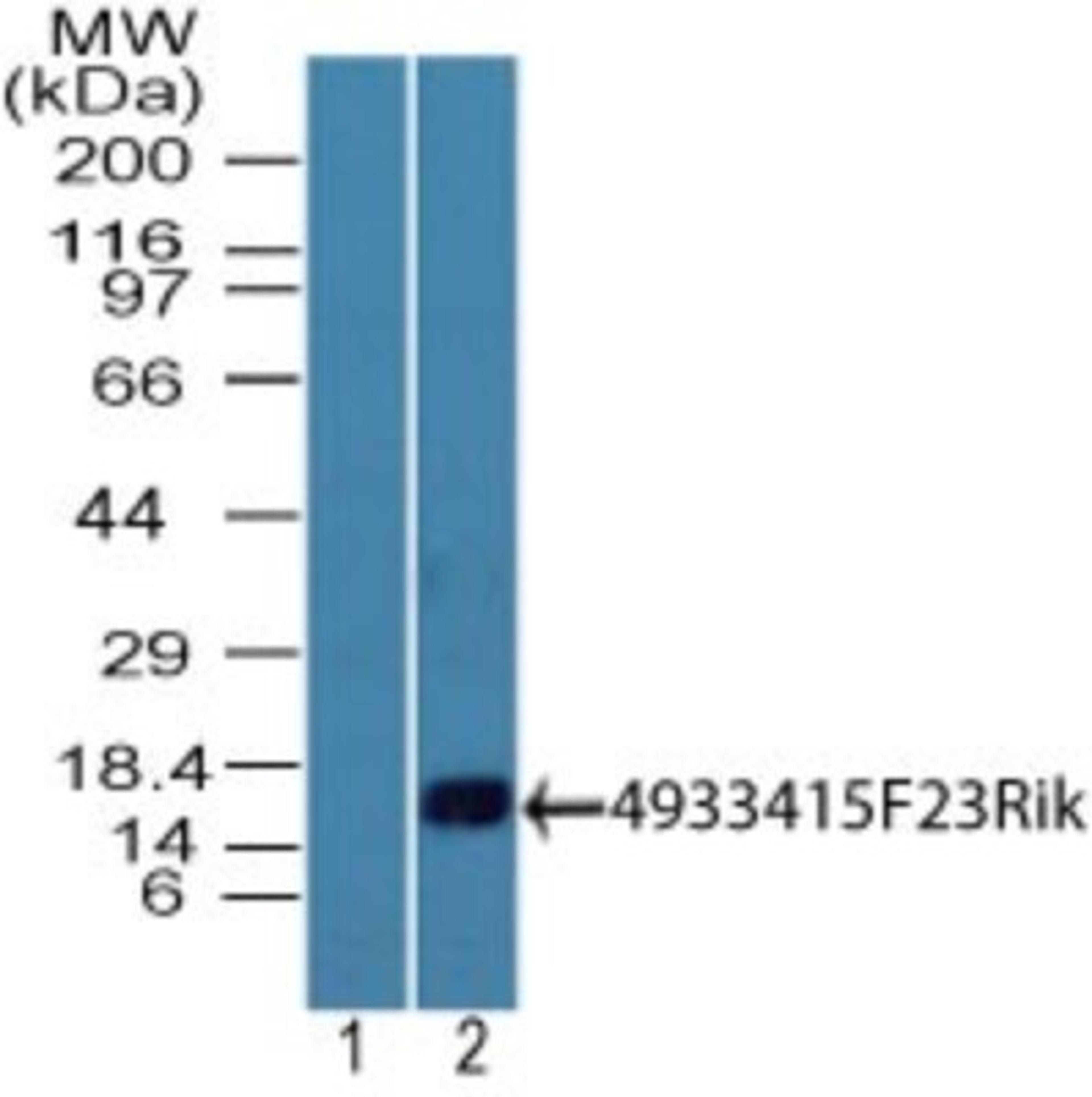 Western Blot: 4933415F23Rik Antibody [NBP2-27164] - Analysis of 4933415F23Rik protein in mouse intestine tissue lysateusing the 1) pre immune seara at 1:5000 dilution and2) this antibody. goat anti-rabbit Ig HRP secondary antibody and PicoTect ECL substrate solution were used for this test.