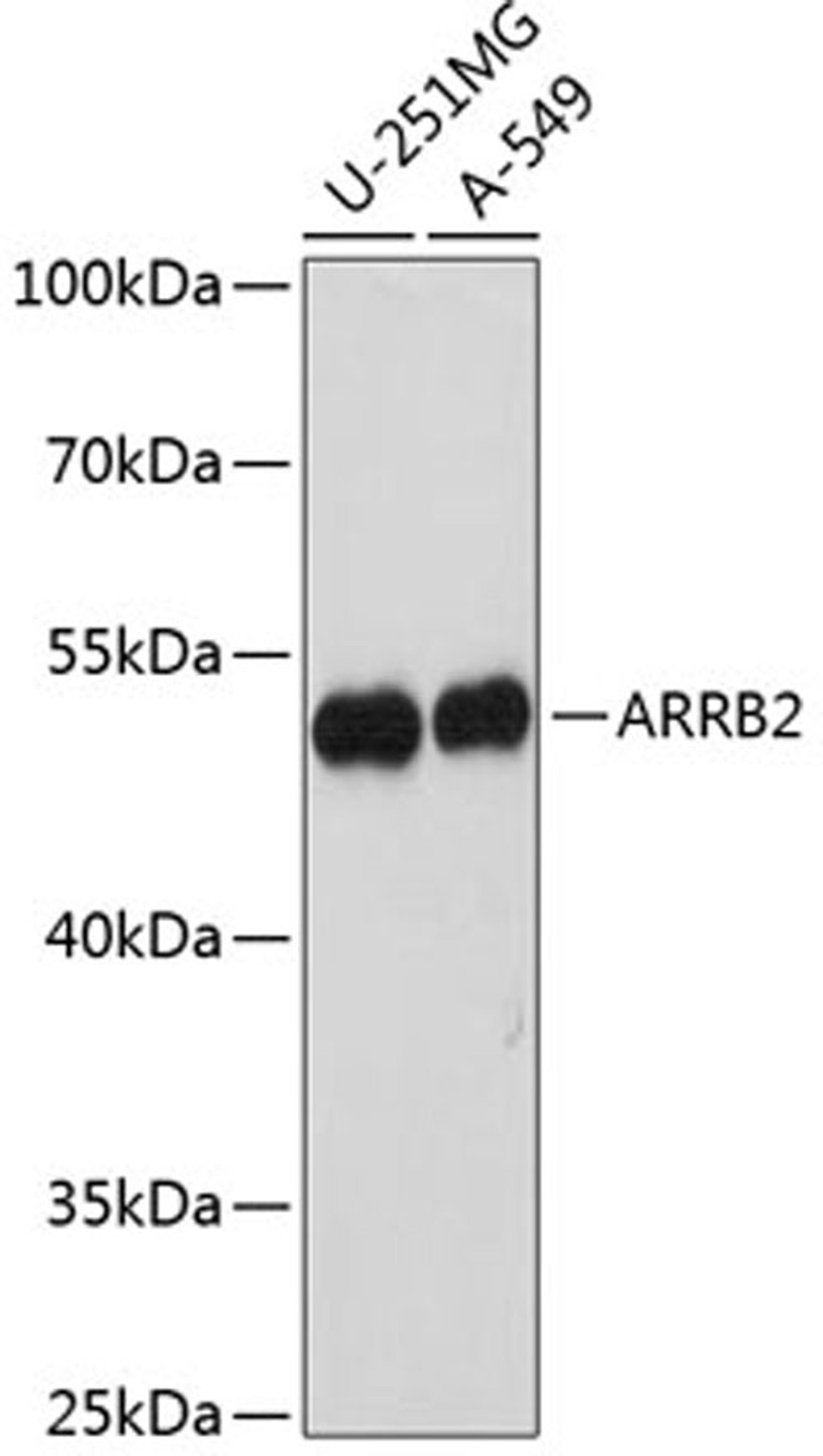 Western blot - ARRB2 antibody (A1171)