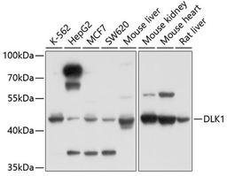 Western blot - DLK1 antibody (A2715)