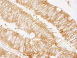 Detection of human KARS by immunohistochemistry.