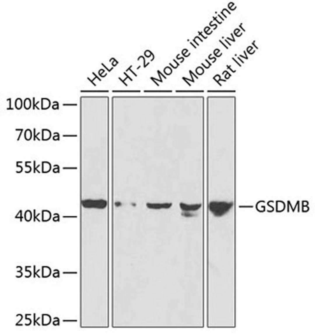 Western blot - GSDMB antibody (A7474)