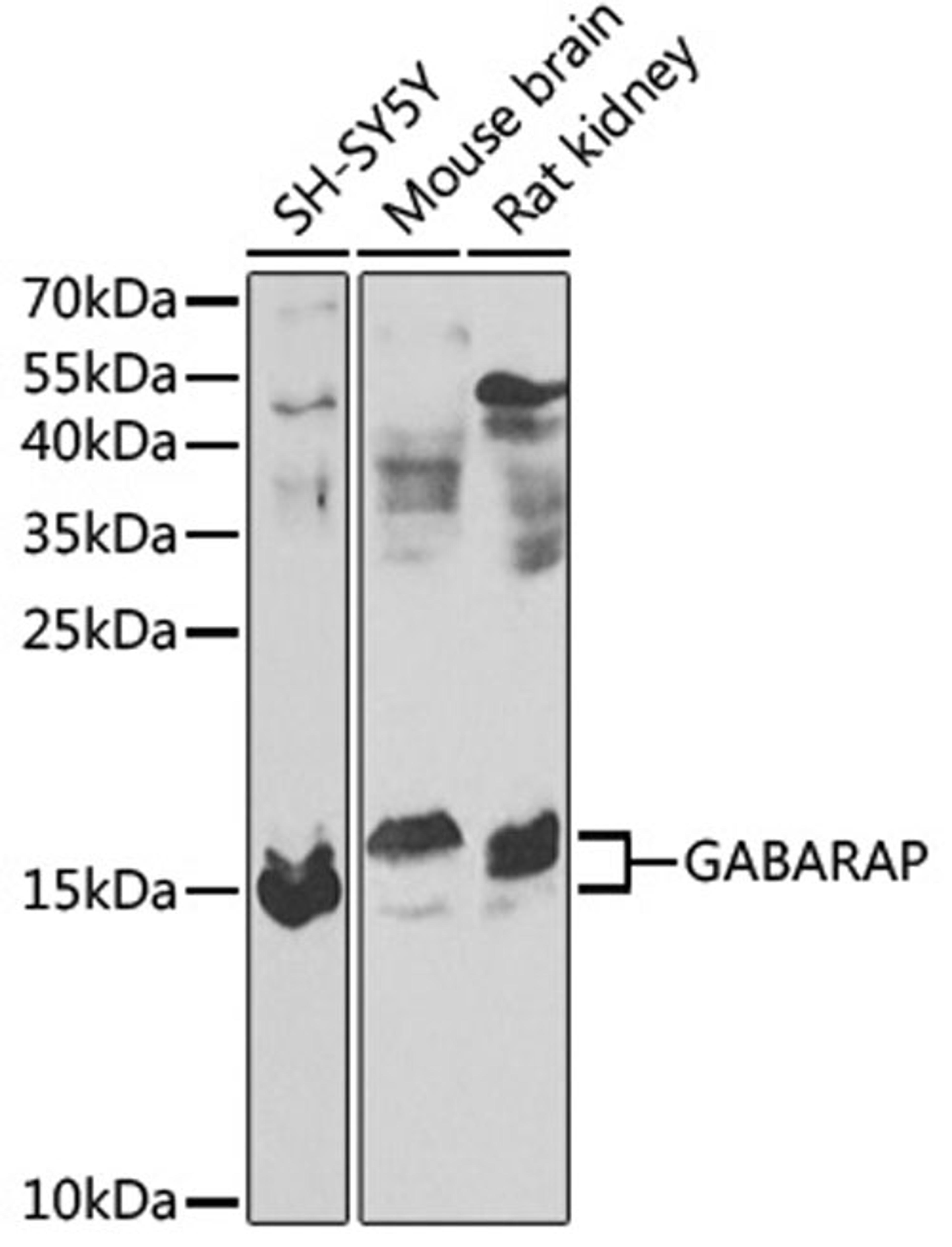 Western blot - GABARAP antibody (A13855)