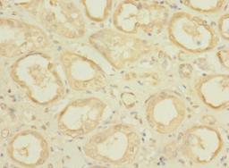 Immunohistochemistry of paraffin-embedded human kidney tissue using CSB-PA669847LA01HU at dilution of 1:100