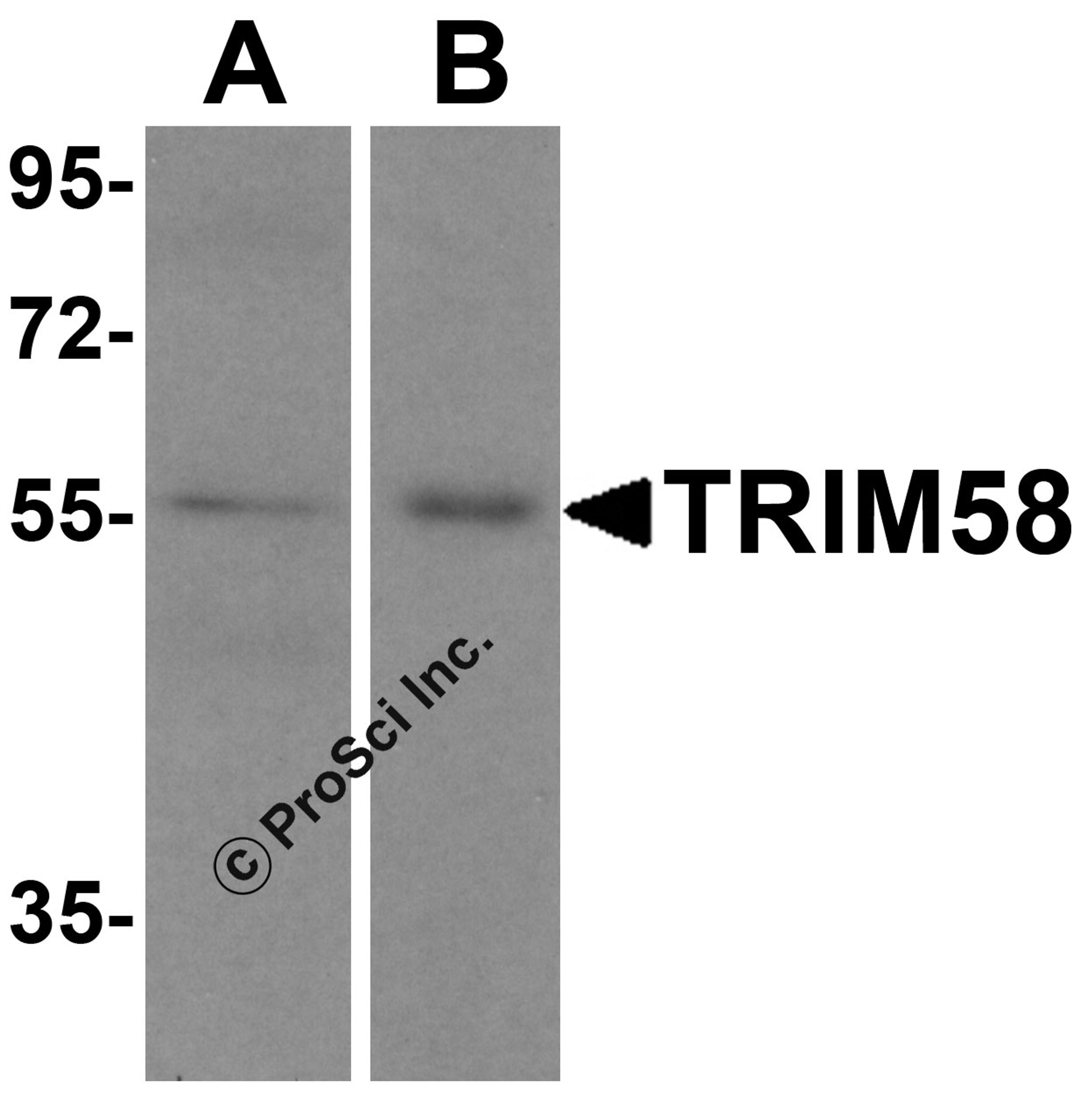 Western blot analysis of TRIM58 in (A) human heart tissue and (B) mouse kidney lysate with TRIM58 antibody at 1 μg/mL.