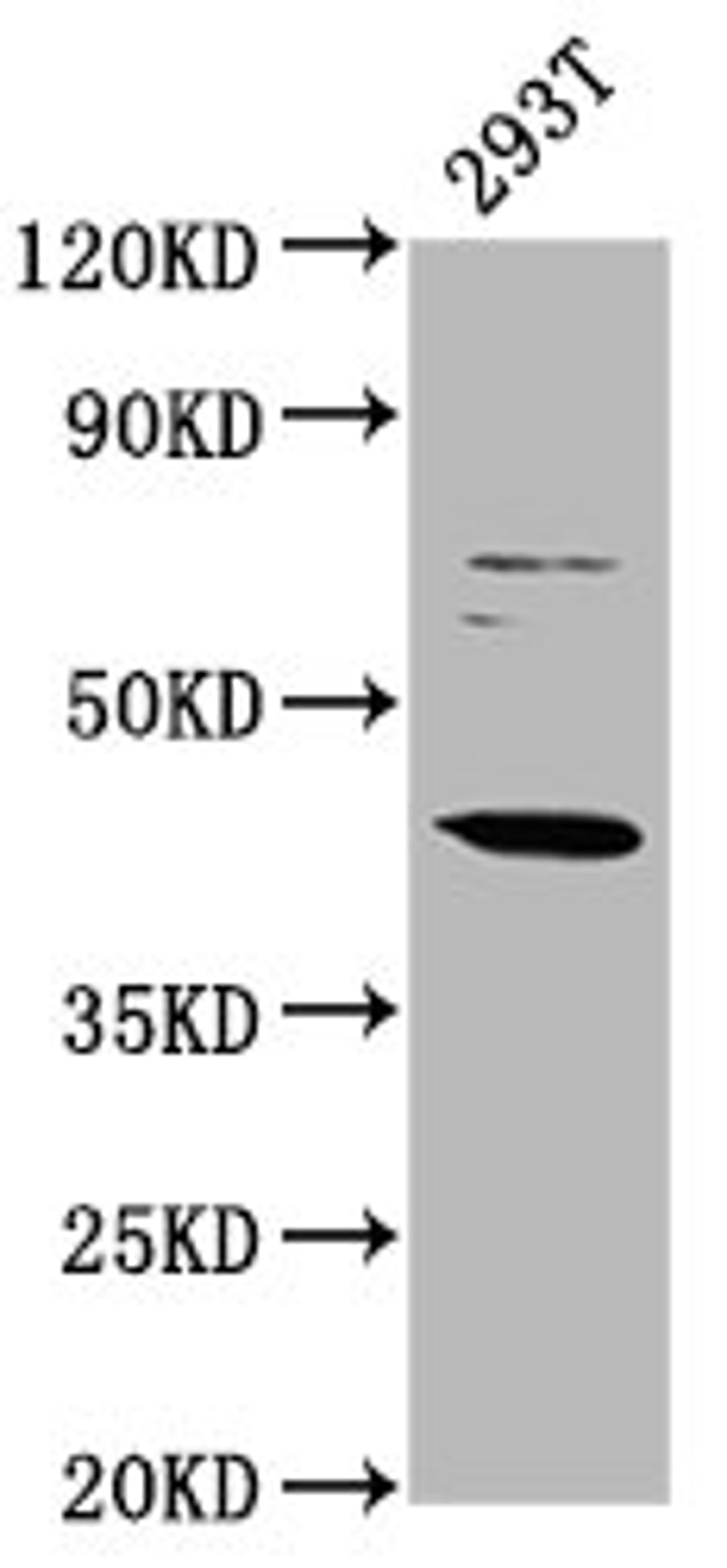 Western Blot. Positive WB detected in: 293T whole cell lysate. All lanes: LHX3 antibody at 3.1µg/ml. Secondary. Goat polyclonal to rabbit IgG at 1/50000 dilution. Predicted band size: 44 kDa. Observed band size: 44 kDa