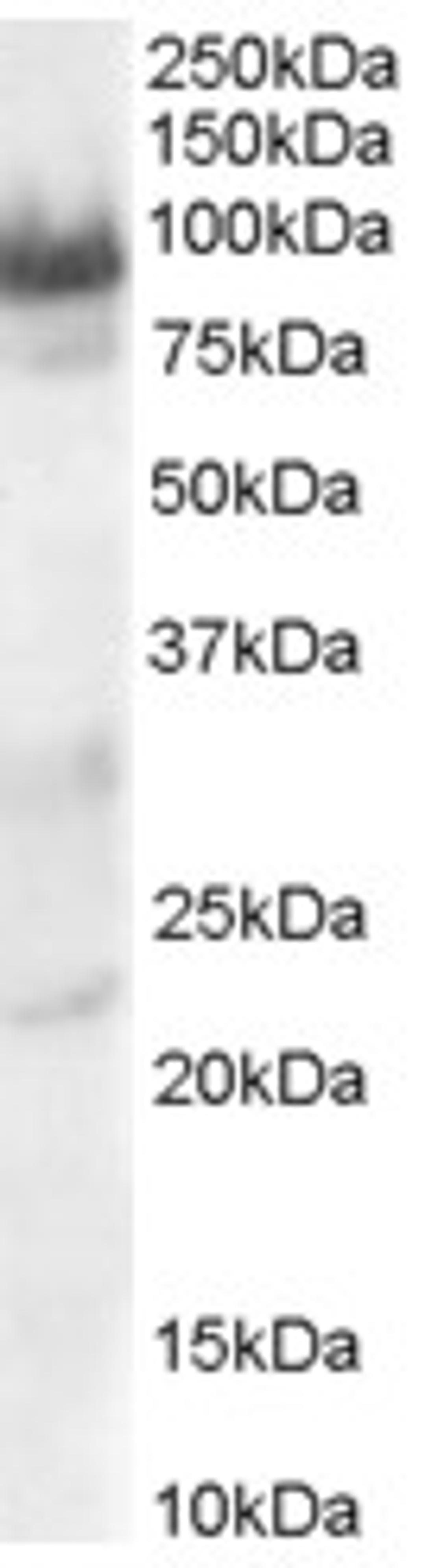 45-996 staining (0.3ug/ml) of Human Heart lysate (RIPA buffer, 30ug total protein per lane). Primary incubated for 1 hour. Detected by chemiluminescence.