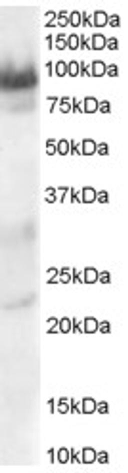 45-996 staining (0.3ug/ml) of Human Heart lysate (RIPA buffer, 30ug total protein per lane). Primary incubated for 1 hour. Detected by chemiluminescence.