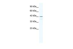 Antibody used in WB on Human Raji at 0.2-1 ug/ml.