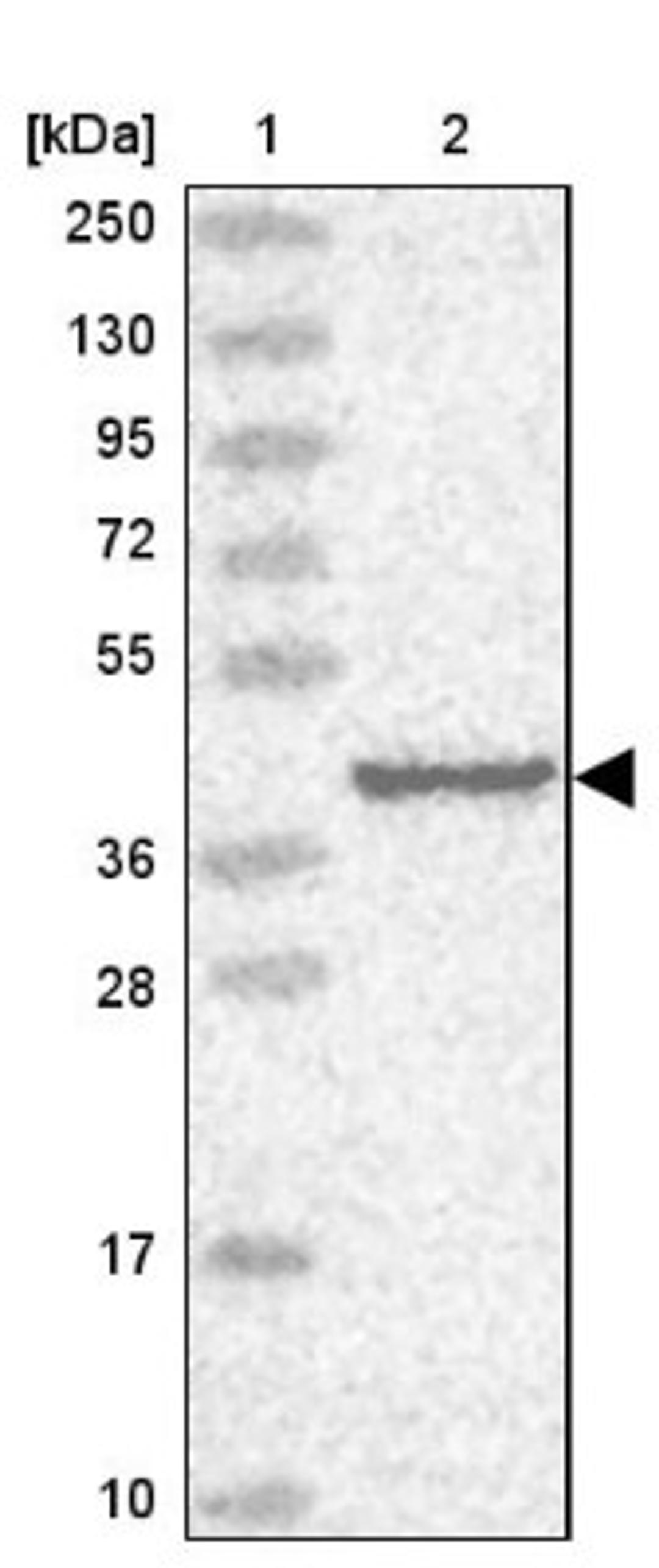 Western Blot: WDR69 Antibody [NBP1-92591] - Lane 1: Marker [kDa] 250, 130, 95, 72, 55, 36, 28, 17, 10<br/>Lane 2: Human cell line RT-4