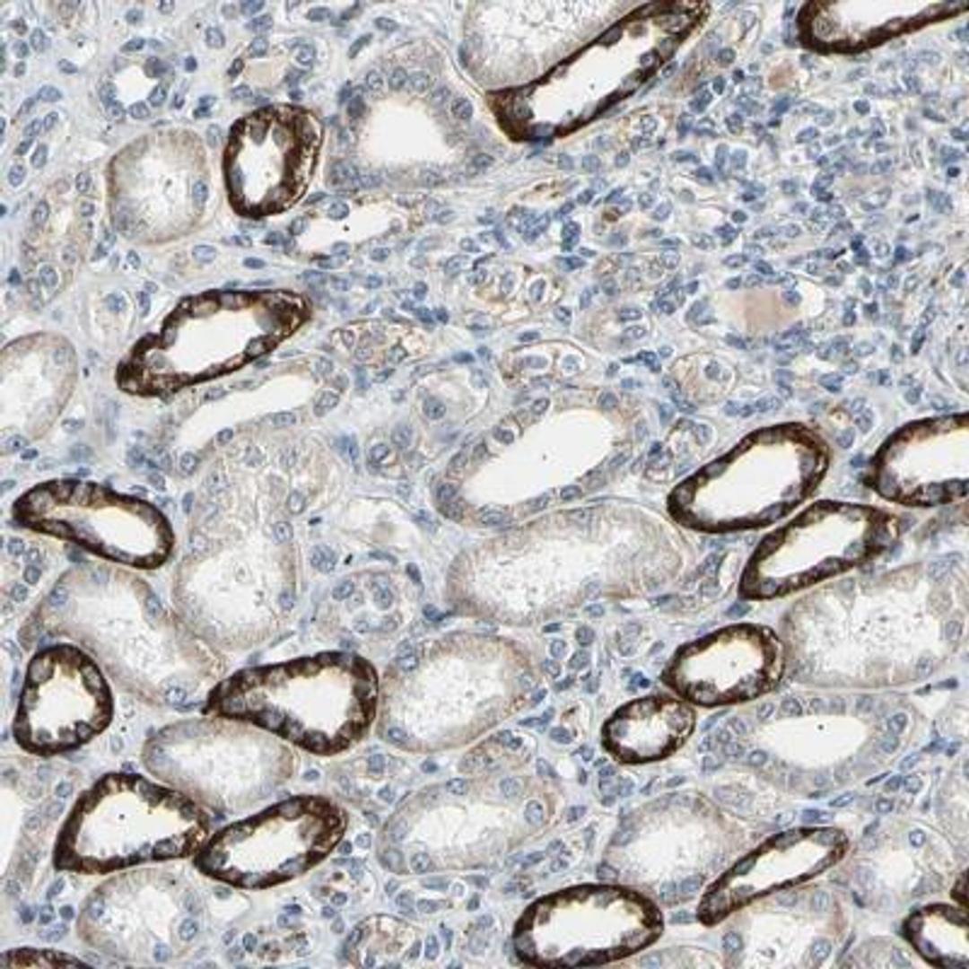 Immunohistochemistry: NDP/Norrin Antibody [NBP1-84769] - Immunohistochemical staining of human kidney shows strong cytoplasmic positivity in renal tubules.