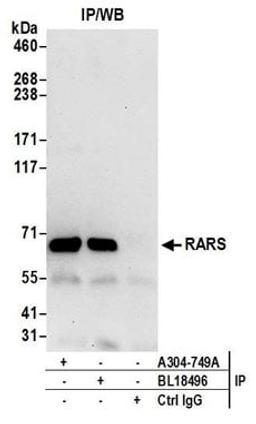 Detection of human RARS by western blot of immunoprecipitates.