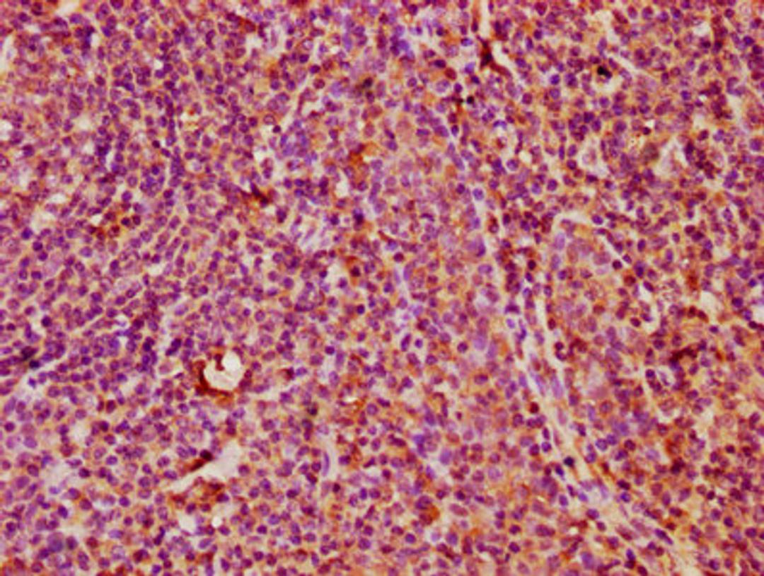 IHC image of CSB-PA23099A0Rb diluted at 1:400 and staining in paraffin-embedded human tonsil tissue performed on a Leica BondTM system. After dewaxing and hydration, antigen retrieval was mediated by high pressure in a citrate buffer (pH 6.0). Section was blocked with 10% normal goat serum 30min at RT. Then primary antibody (1% BSA) was incubated at 4&deg;C overnight. The primary is detected by a biotinylated secondary antibody and visualized using an HRP conjugated SP system.