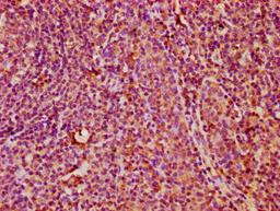 IHC image of CSB-PA23099A0Rb diluted at 1:400 and staining in paraffin-embedded human tonsil tissue performed on a Leica BondTM system. After dewaxing and hydration, antigen retrieval was mediated by high pressure in a citrate buffer (pH 6.0). Section was blocked with 10% normal goat serum 30min at RT. Then primary antibody (1% BSA) was incubated at 4&deg;C overnight. The primary is detected by a biotinylated secondary antibody and visualized using an HRP conjugated SP system.