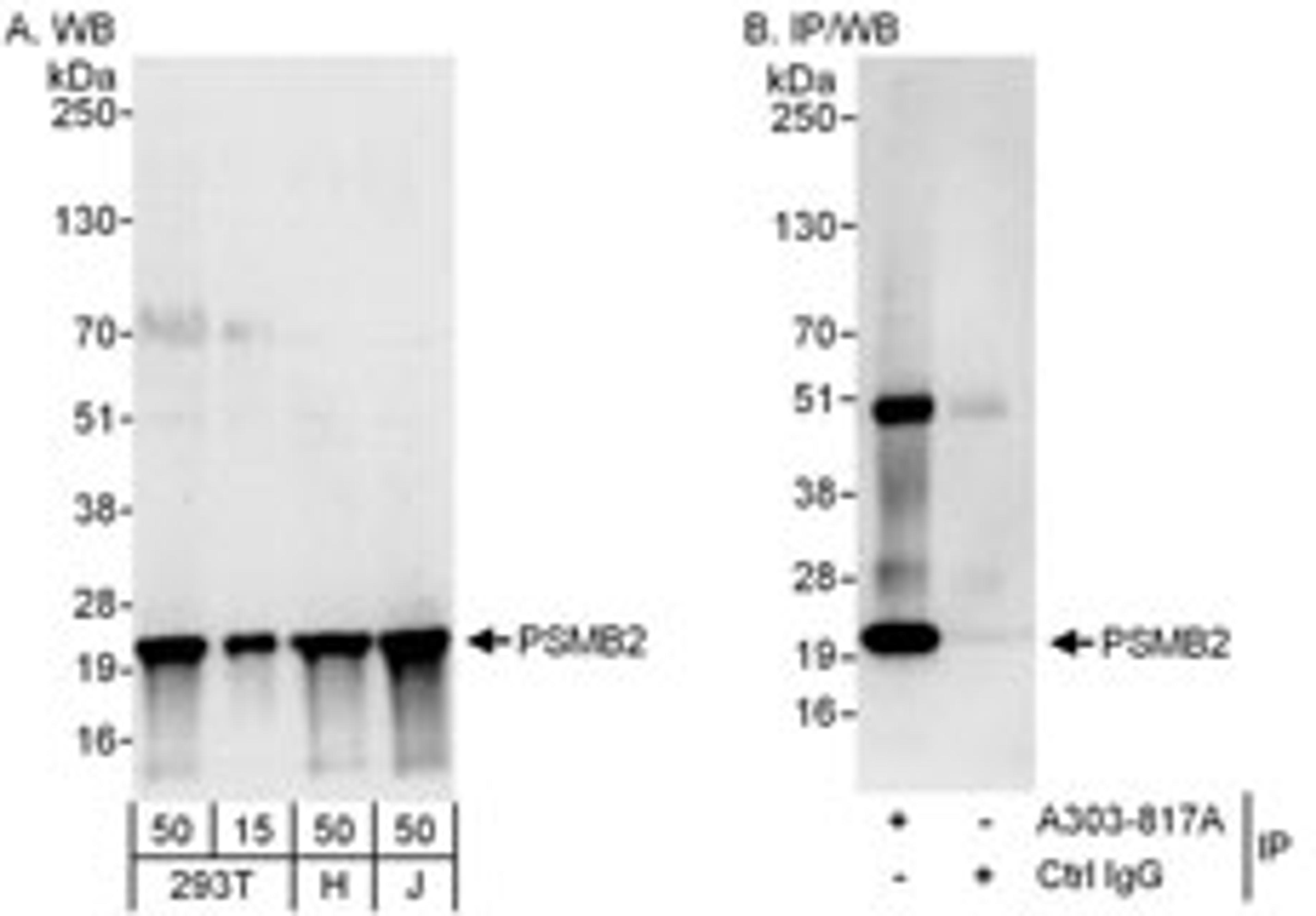 Detection of human PSMB2 by western blot and immunoprecipitation.