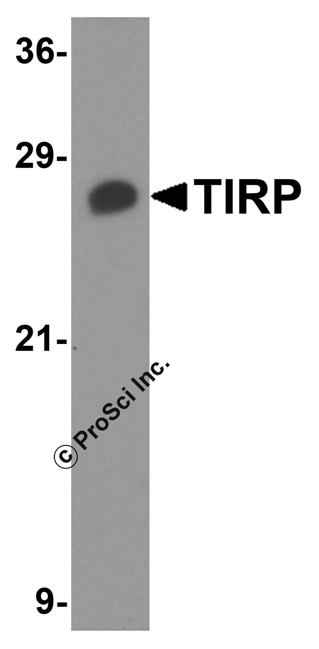 Western blot analysis of TIRP in PC-3 cell lysate with TIRP antibody at 1 μg/mL.