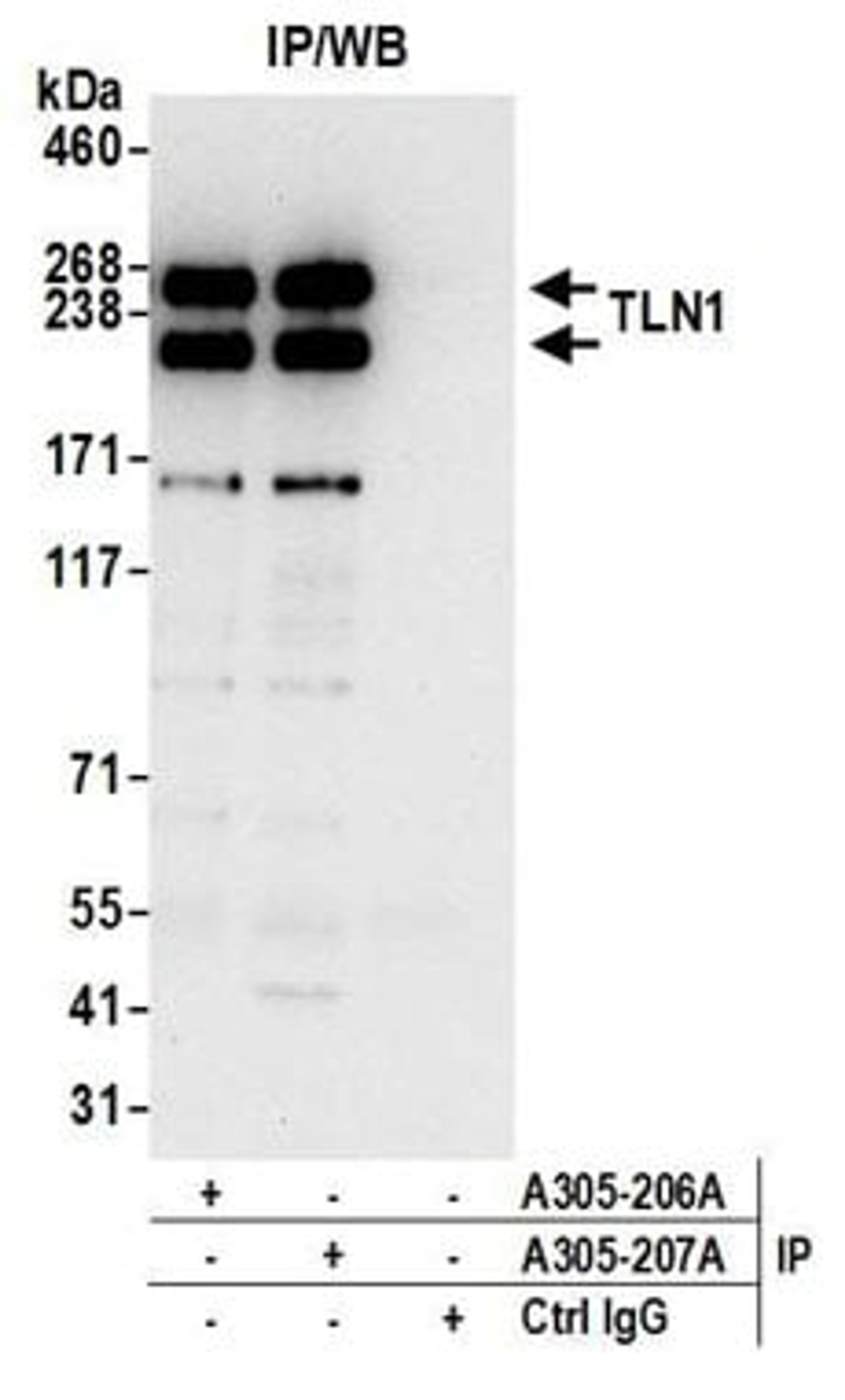 Detection of human TLN1 by western blot of immunoprecipitates.