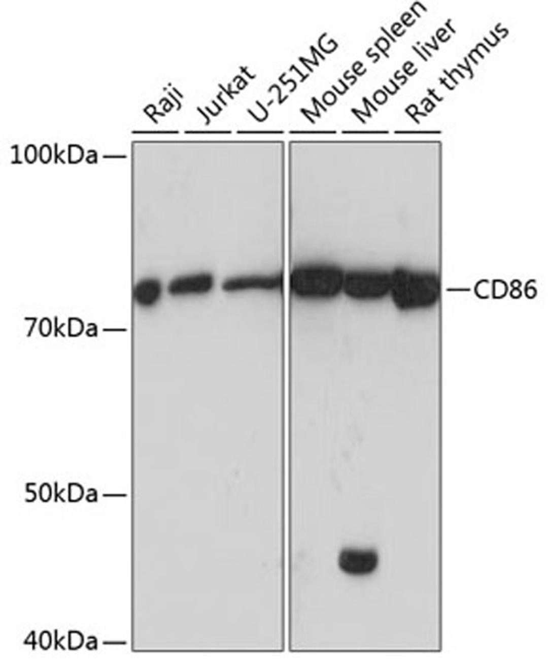 Western blot - CD86 antibody (A19026)