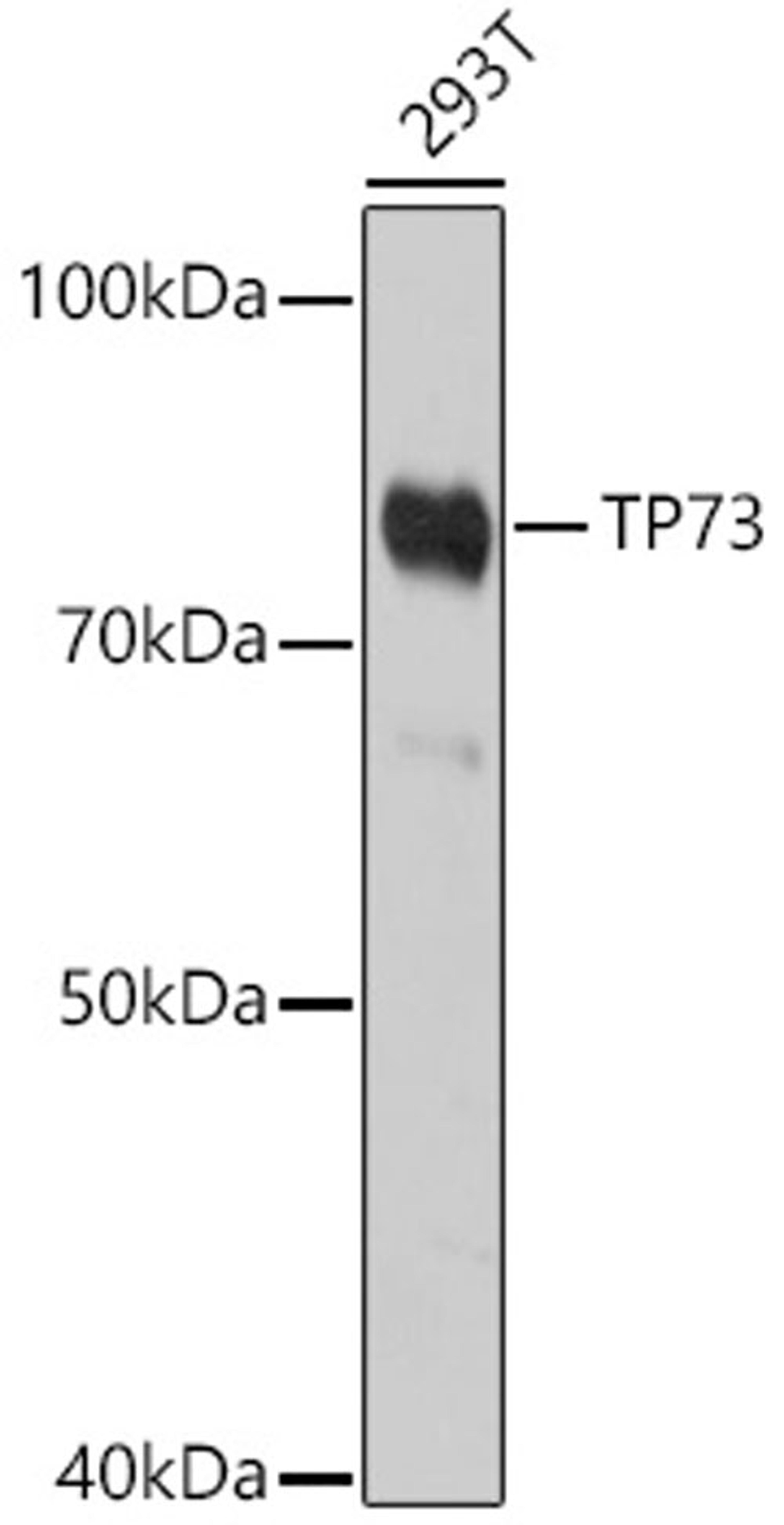 Western blot - TP73 antibody (A0385)