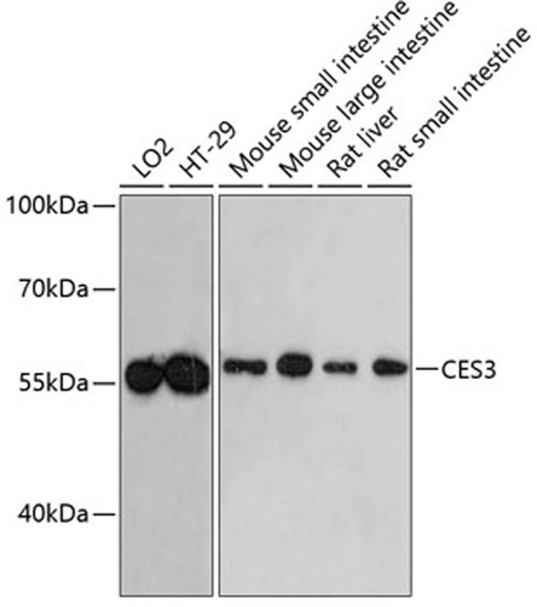 Western blot - CES3 antibody (A4558)