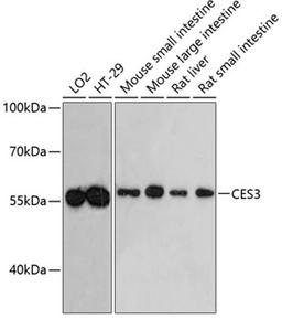 Western blot - CES3 antibody (A4558)