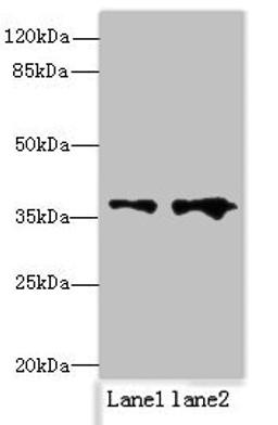 Western blot. All lanes: RPRD1B antibody at 0.2ug/ml. Lane 1: Jurkat whole cell lysate. Lane 2: 293T whole cell lysate. Secondary. Goat polyclonal to rabbit IgG at 1/10000 dilution. Predicted band size: 37 kDa. Observed band size: 37 kDa. 