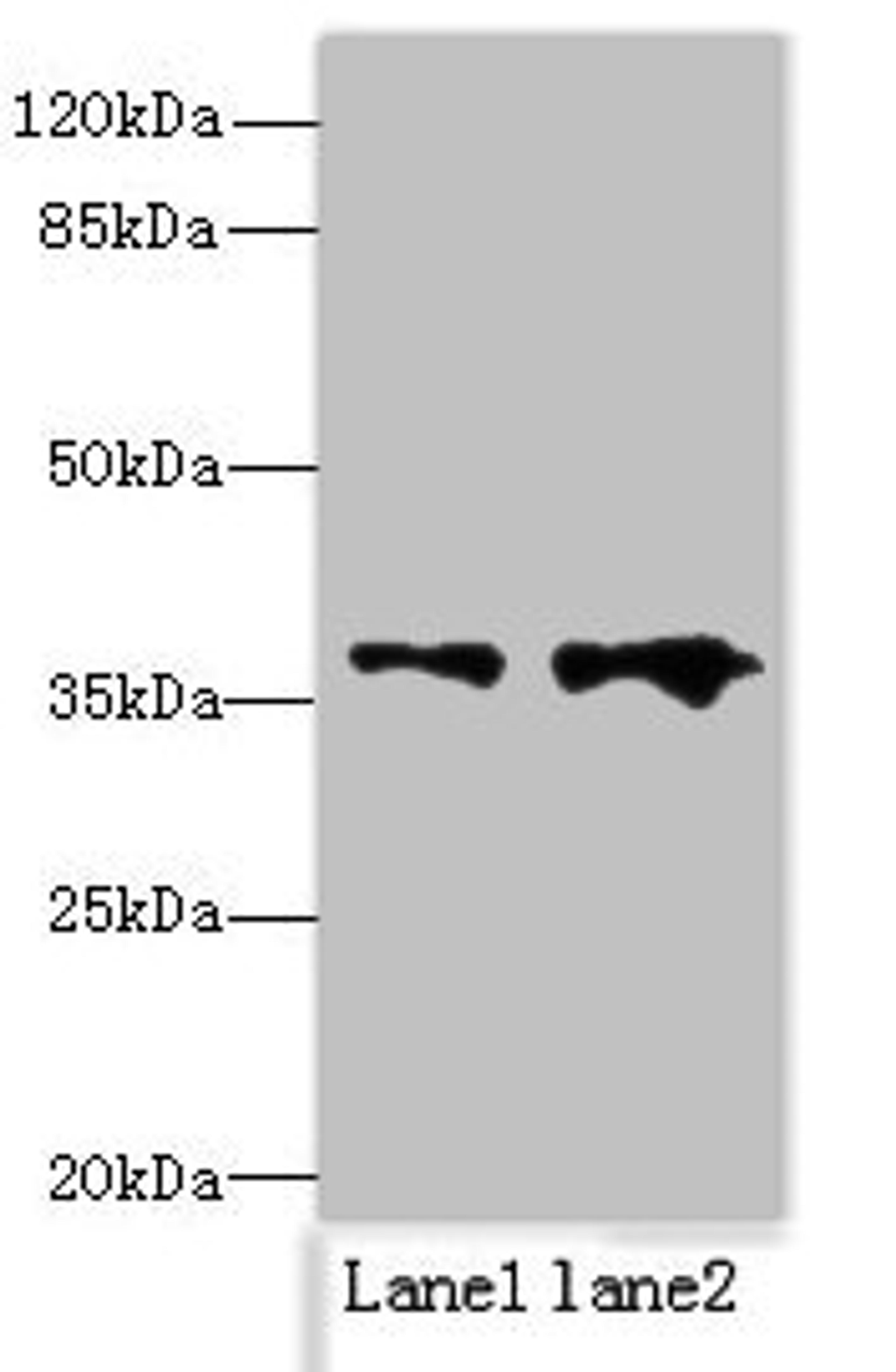 Western blot. All lanes: RPRD1B antibody at 0.2ug/ml. Lane 1: Jurkat whole cell lysate. Lane 2: 293T whole cell lysate. Secondary. Goat polyclonal to rabbit IgG at 1/10000 dilution. Predicted band size: 37 kDa. Observed band size: 37 kDa. 