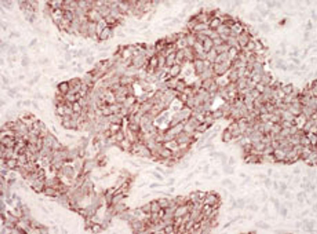 Detection of human HSP60 by immunohistochemistry.