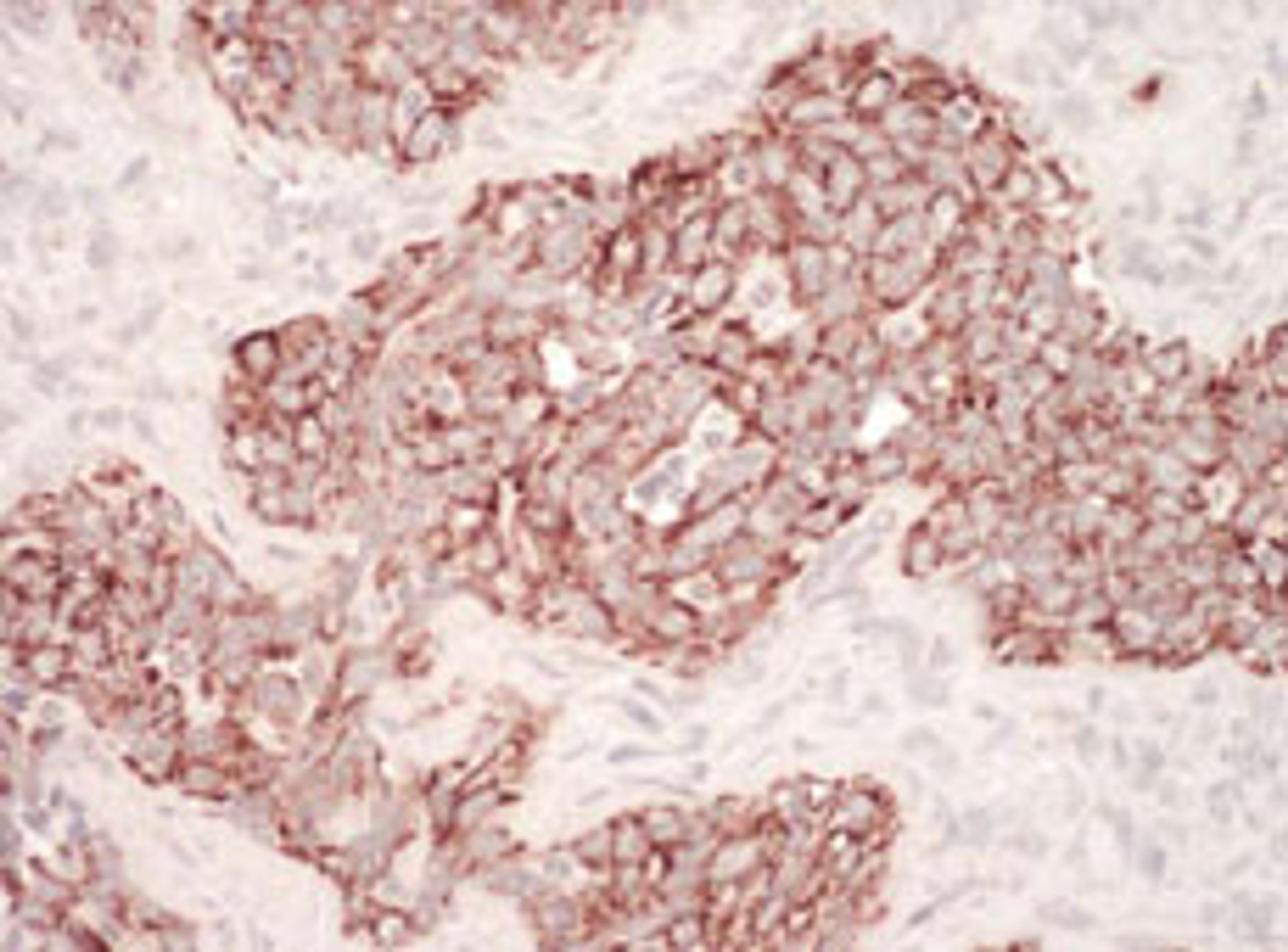 Detection of human HSP60 by immunohistochemistry.