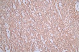 IHC image of CSB-RA588962A0HU diluted at 1:50 and staining in paraffin-embedded human brain tissue performed on a Leica BondTM system. After dewaxing and hydration, antigen retrieval was mediated by high pressure in a citrate buffer (pH 6.0). Section was blocked with 10% normal goat serum 30min at RT. Then primary antibody (1% BSA) was incubated at 4°C overnight. The primary is detected by a Goat anti-rabbit polymer IgG labeled by HRP and visualized using 0.76% DAB.