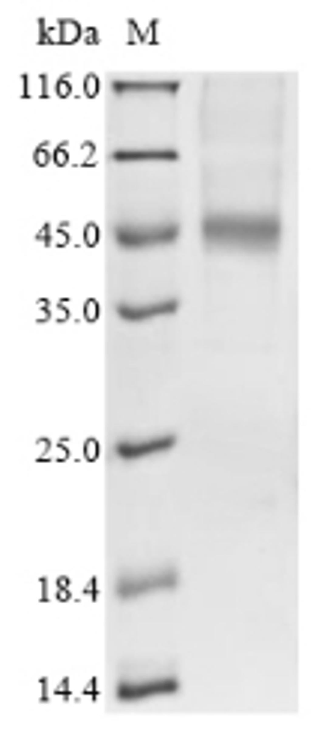 (Tris-Glycine gel) Discontinuous SDS-PAGE (reduced) with 5% enrichment gel and 15% separation gel.