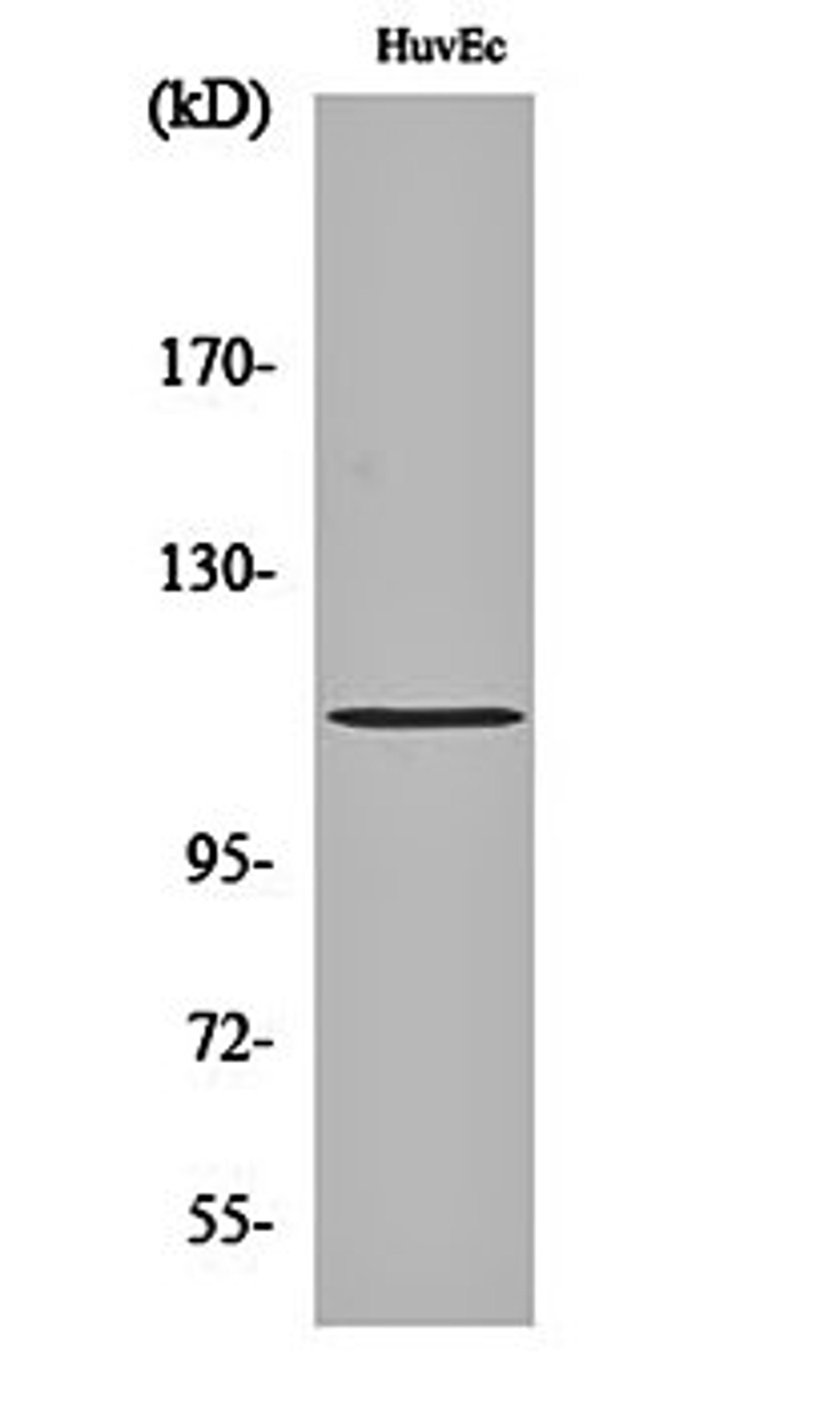 Western blot analysis of HuvEc cell lysates using Rb (phospho-S807) antibody