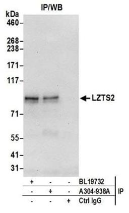 Detection of human LZTS2 by western blot of immunoprecipitates.