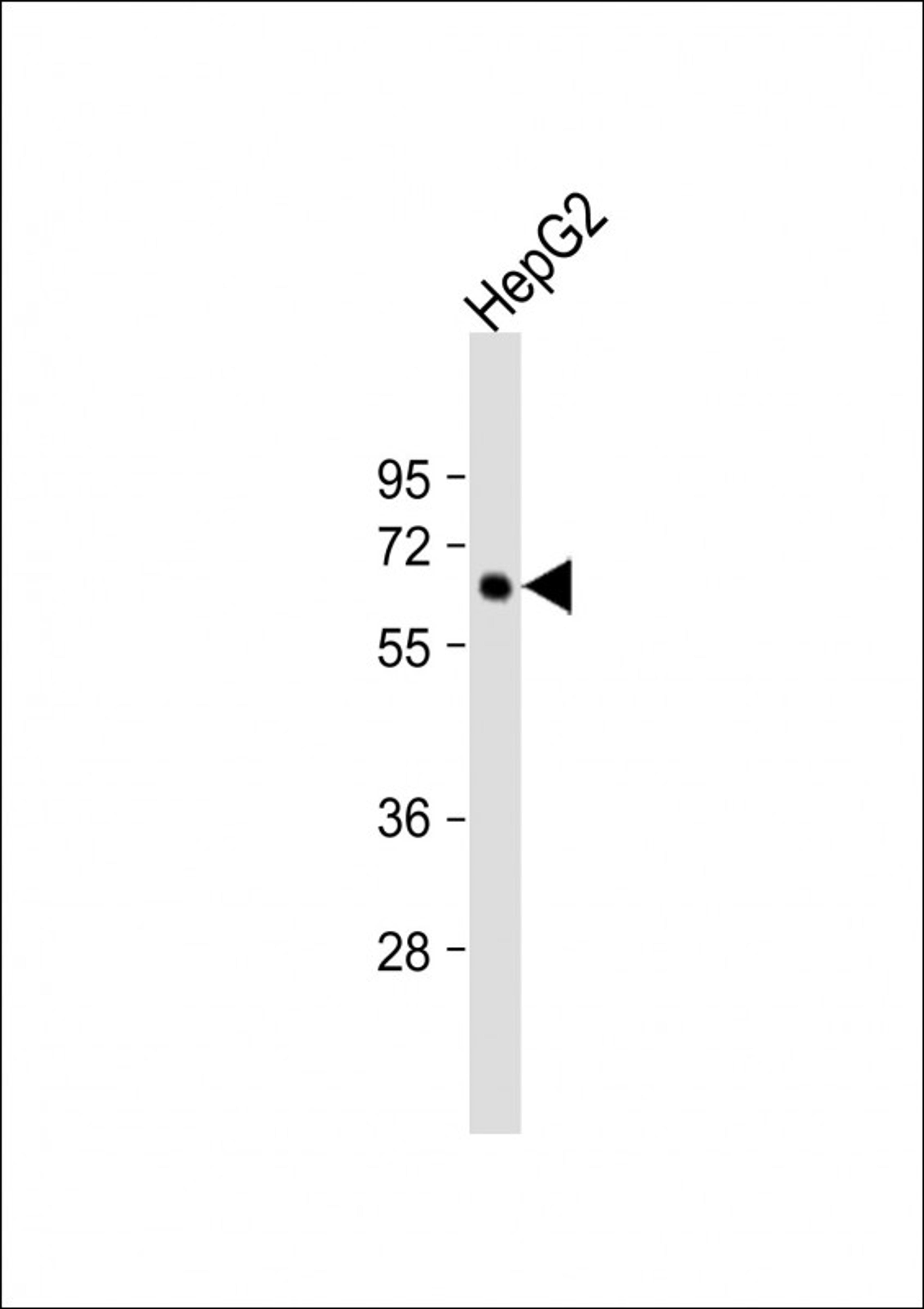 Western Blot at 1:4000 dilution + HepG2 whole cell lysate Lysates/proteins at 20 ug per lane.