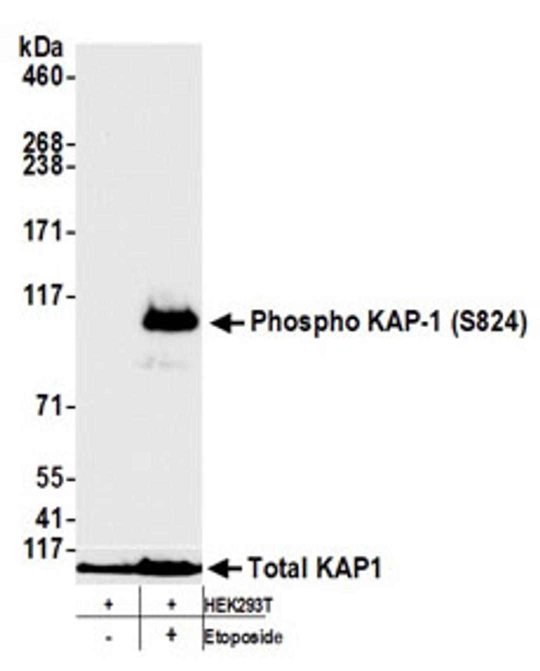 Detection of human Phospho KAP-1 (S824) by western blot.