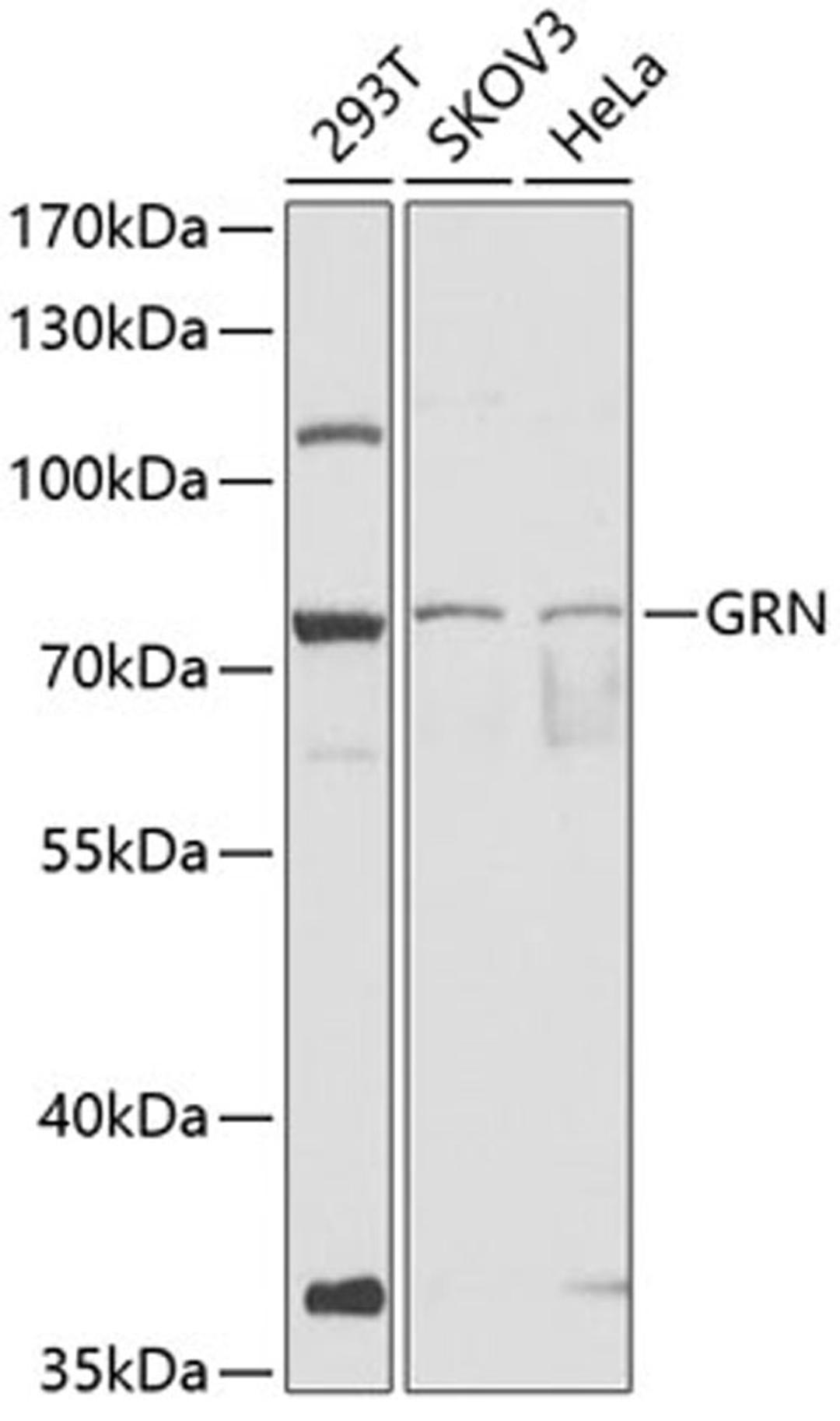 Western blot - GRN antibody (A12440)