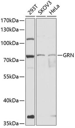 Western blot - GRN antibody (A12440)