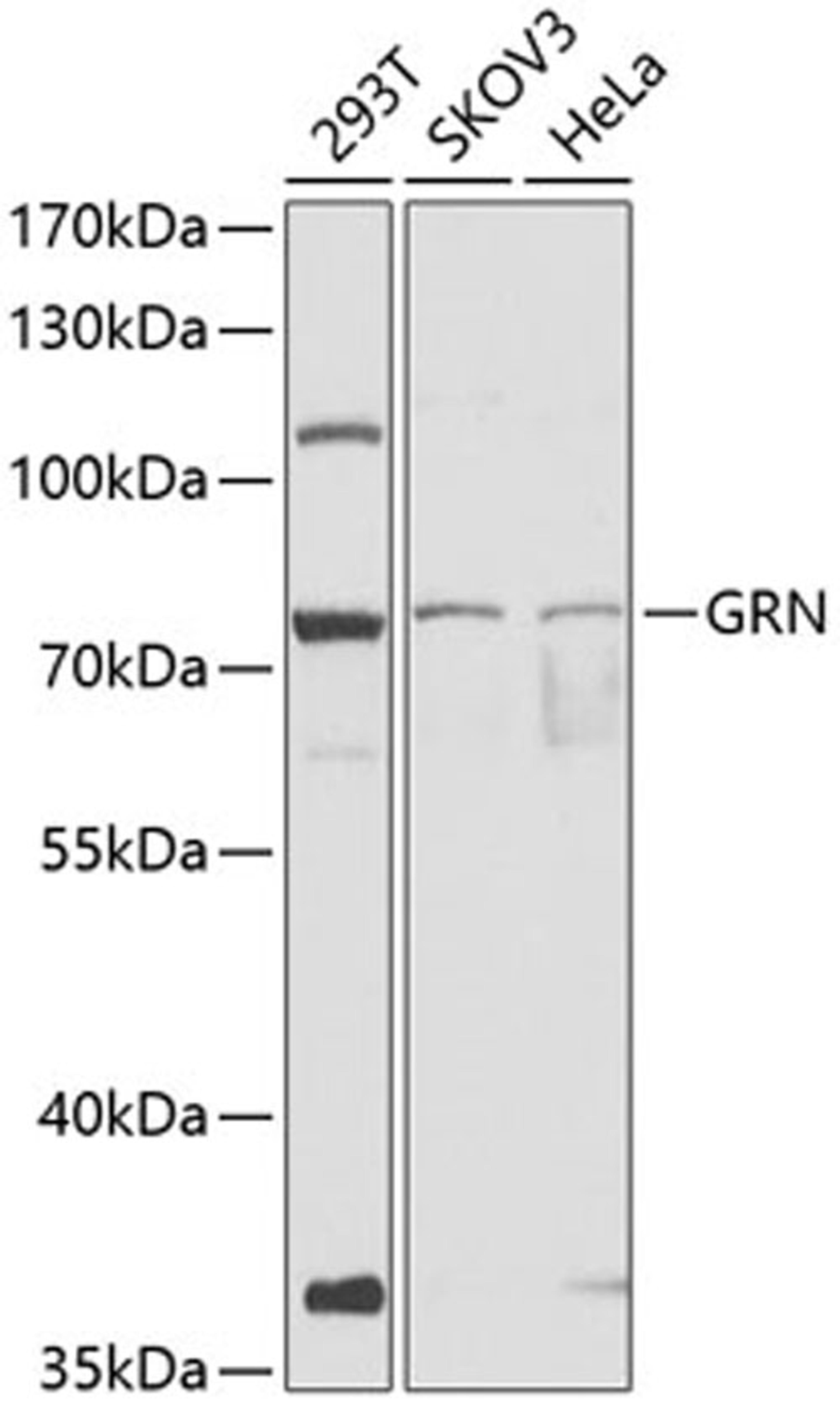 Western blot - GRN antibody (A12440)