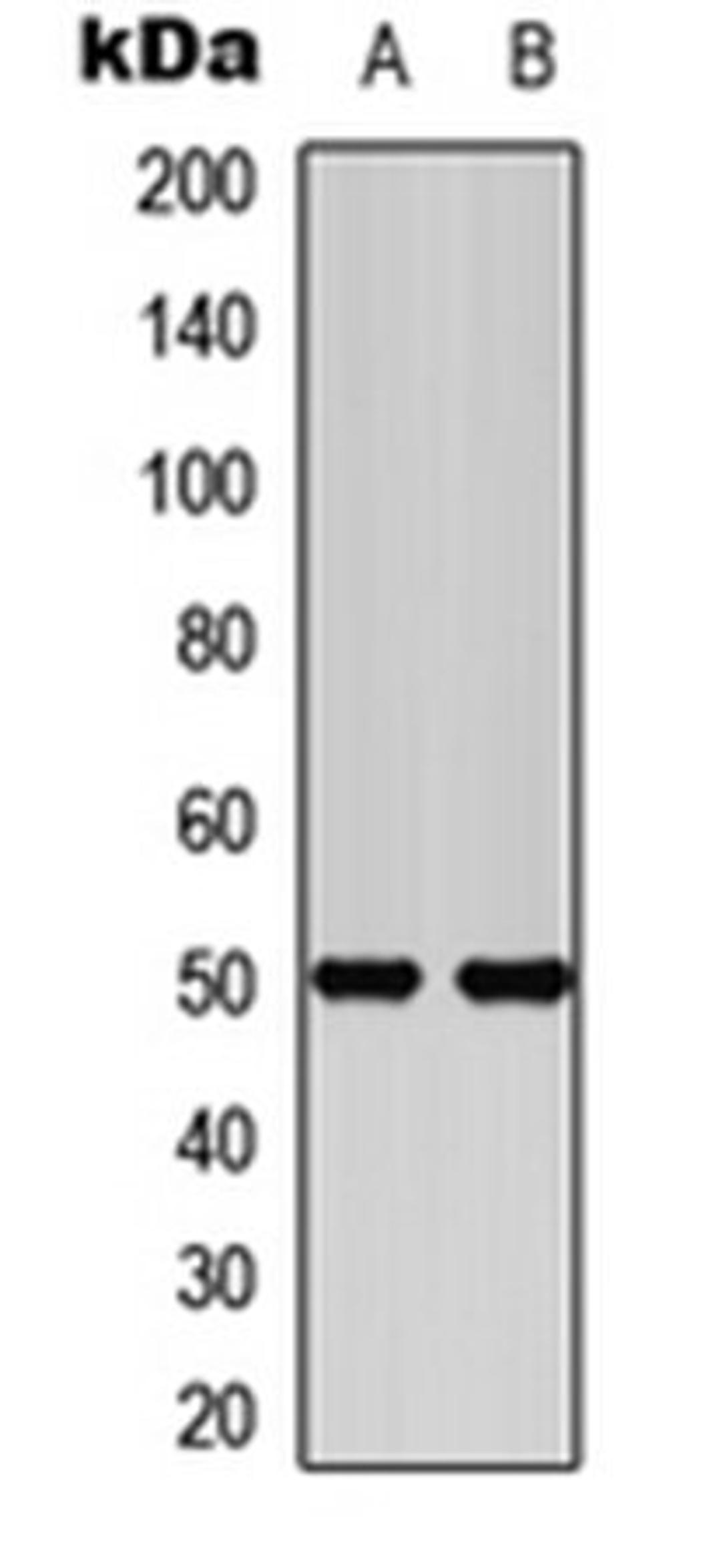 Western blot analysis of SHSY5Y (Lane 1), HEK293T (Lane 2) whole cell lysates using Secretin Receptor antibody