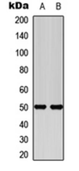 Western blot analysis of SHSY5Y (Lane 1), HEK293T (Lane 2) whole cell lysates using Secretin Receptor antibody