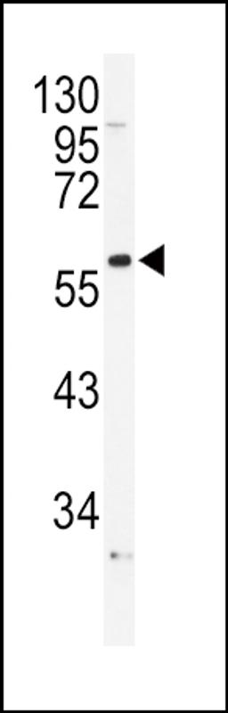 Western blot analysis of ADRA1B Antibody in NCI-H460 cell line lysates (35ug/lane)